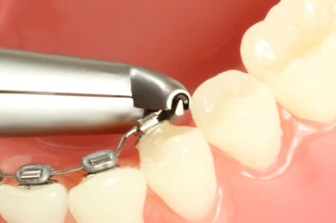 Pinza Per Capelli French Demi In Acetato - CM 5, Colore Marrone Tartaruga, Made In France - Foto 3